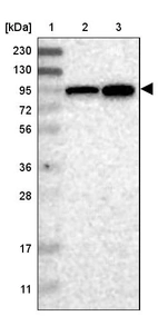 Lane 1: Marker [kDa] 230, 130, 95, 72, 56, 36, 28, 17, 11_br/_Lane 2: Human cell line RT-4_br/_Lane 3: Human cell line U-251MG sp