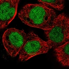Immunofluorescent staining of human cell line A-431 shows localization to nucleoplasm.