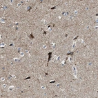 Immunohistochemical staining of human cerebral cortex shows strong cytoplasmic positivity in neurons.
