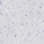 Immunohistochemical staining of human skeletal muscle shows no positivity in myocytes as expected.