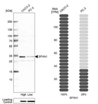Western blot analysis in human cell line CACO-2 and human cell line PC-3.