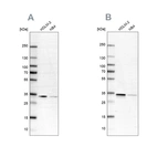 Western blot analysis using Anti-SFXN1 antibody HPA019543 (A) shows similar pattern to independent antibody HPA063745 (B).
