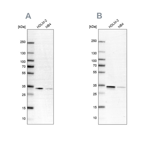 Rabbit Polyclonal Anti-SFXN1 Antibody - Buy for research