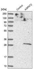 Western blot analysis in control (vector only transfected HEK293T lysate) and AGPAT2 over-expression lysate (Co-expressed with a C-terminal myc-DDK tag (~3.1 kDa) in mammalian HEK293T cells, LY401930).