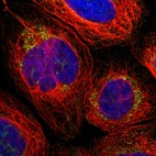 Immunofluorescent staining of human cell line A-431 shows localization to mitochondria.