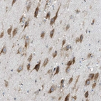 Anti-LMBRD1 Antibody
