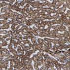 Anti-ZNF629 Antibody