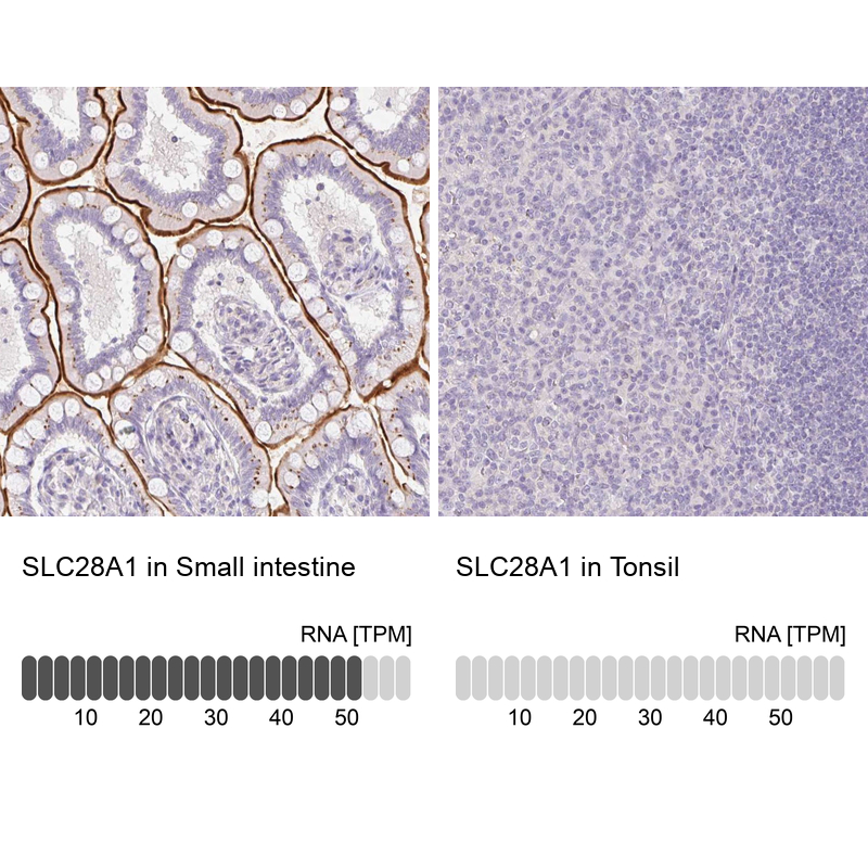 Anti-SLC28A1 Antibody