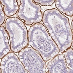 Immunohistochemical staining of human small intestine shows high expression.