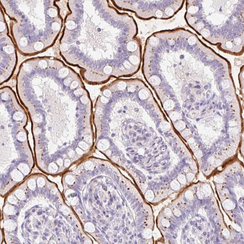 Anti-SLC28A1 Antibody