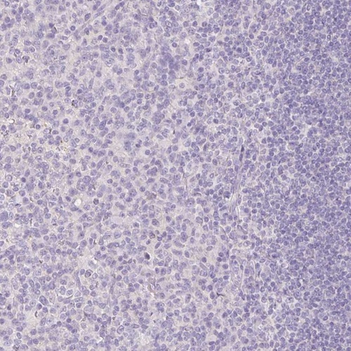 Anti-SLC28A1 Antibody
