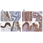 Anti-ANXA13 Antibody