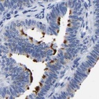 Immunohistochemical staining of human fallopian tube using Anti-ANXA13 antibody HPA019569.