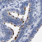Immunohistochemical staining of human fallopian tube using Anti-ANXA13 antibody HPA019569.