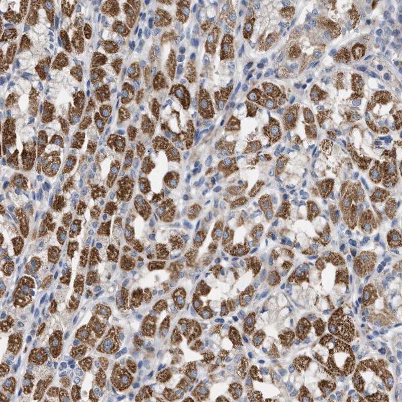 Anti-DHX58 Antibody
