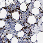 Immunohistochemical staining of human bone marrow shows strong nuclear positivity in hematopoietic cells.