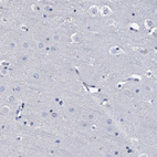Immunohistochemical staining of human cerebral cortex shows no positivity in neurons as expected.
