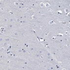 Immunohistochemical staining of human cerebral cortex shows no positivity in neurons as expected.