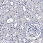 Immunohistochemical staining of human kidney shows no positivity in cells in tubules as expected.