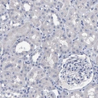 Immunohistochemical staining of human kidney shows no positivity in cells in tubules as expected.