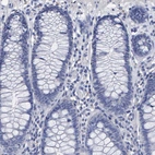 Immunohistochemical staining of human colon shows no positivity in glandular cells as expected.