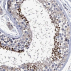 Immunohistochemical staining of human testis shows strong nuclear positivity in cells in seminiferous ducts.