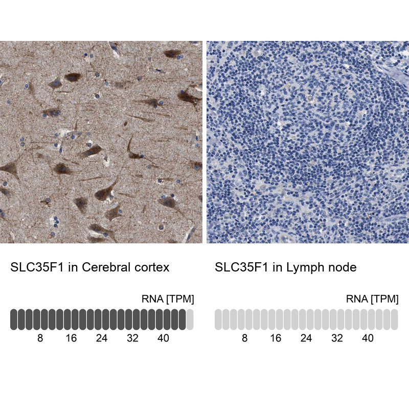Anti-SLC35F1 Antibody