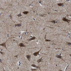 Immunohistochemical staining of human cerebral cortex shows high expression.