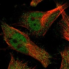 Immunofluorescent staining of human cell line U-251 MG shows localization to nucleoplasm & cytosol.