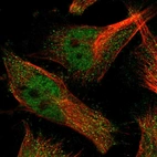 Immunofluorescent staining of human cell line U-251 MG shows localization to nucleoplasm & cytosol.