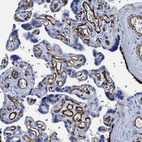 Immunohistochemical staining of human placenta shows strong cytoplasmic positivity in endothelial cells.