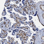 Immunohistochemical staining of human placenta shows strong cytoplasmic positivity in endothelial cells.