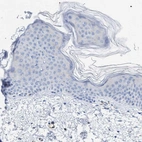 Immunohistochemical staining of human skin shows no positivity in squamous epithelial cells as expected.