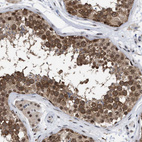 Anti-UPF1 Antibody