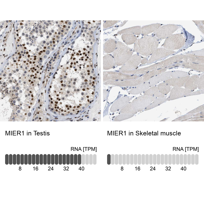 Anti-MIER1 Antibody