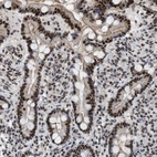 Immunohistochemical staining of human duodenum shows strong nuclear positivity in glandular cells.
