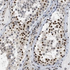 Immunohistochemical staining of human testis shows moderate to strong nuclear positivity in cells in seminiferous ducts.
