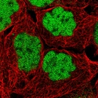 Immunofluorescent staining of human cell line A-431 shows localization to nucleoplasm.