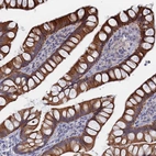 Immunohistochemical staining of human Small intestine shows strong cytoplasmic and membranous positivity in glandular cells.