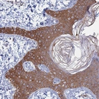 Immunohistochemical staining of human Skin shows strong cytoplasmic and membranous positivity in squamous epithelial cells.