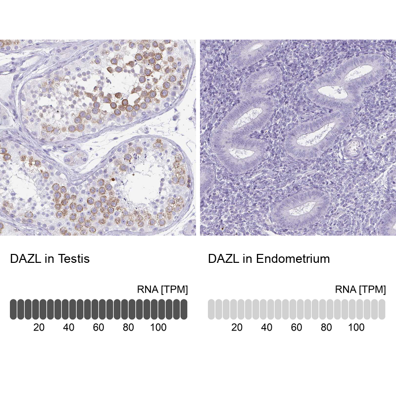 Anti-DAZL Antibody
