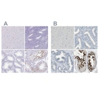 Immunohistochemical staining of human cerebral cortex, endometrium, prostate and testis using Anti-DAZL antibody HPA019593 (A) shows similar protein distribution across tissues to independent antibody HPA019777 (B).