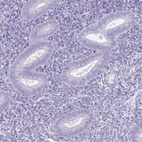 Immunohistochemical staining of human endometrium shows no positivity in glandular cells as expected.