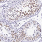 Immunohistochemical staining of human testis shows moderate cytoplasmic positivity in cells in seminiferous ducts.