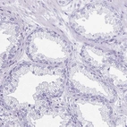 Immunohistochemical staining of human prostate shows no positivity in glandular cells as expected.