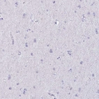 Immunohistochemical staining of human cerebral cortex shows no positivity in neurons as expected.