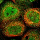 Immunofluorescent staining of human cell line A-431 shows localization to nucleoplasm & cytosol.