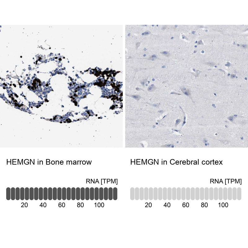 Anti-HEMGN Antibody