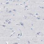 Immunohistochemical staining of human cerebral cortex shows no positivity in neurons as expected.