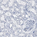 Immunohistochemical staining of human kidney shows no positivity in cells in tubules as expected.